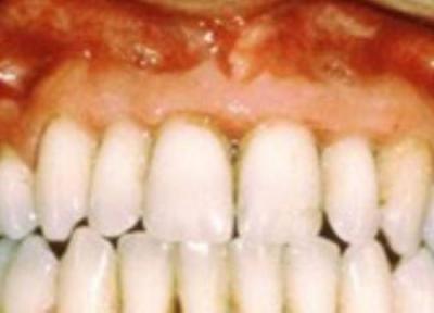 8 باور غلط درباره دندان ها