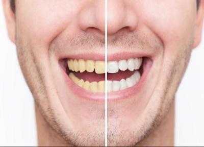 13 ماده غذایی که به طور طبیعی دندان های زرد را سفید و درخشان می کنند