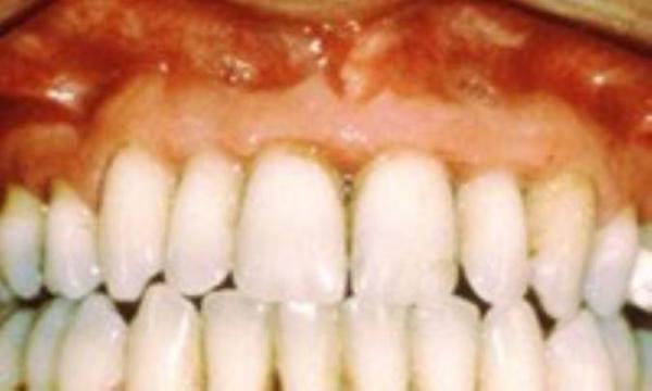 8 باور غلط درباره دندان ها