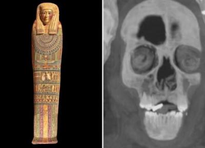 رازهایی که سی تی اسکن یک مومیایی 2300 ساله فاش کرد ، پسر طلایی مصر با 49 طلسم عجیب